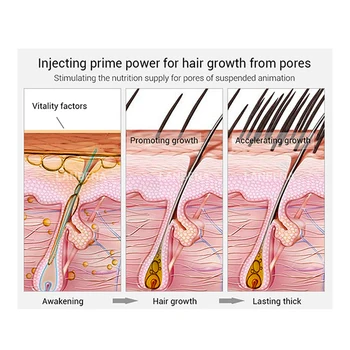 Vypadávanie Vlasov, Prírodné Produkty Bez Vedľajších Účinkov Rásť Vlasy Rýchlejšie Opätovný Rast Vlasov Produktov Rast Nových 3